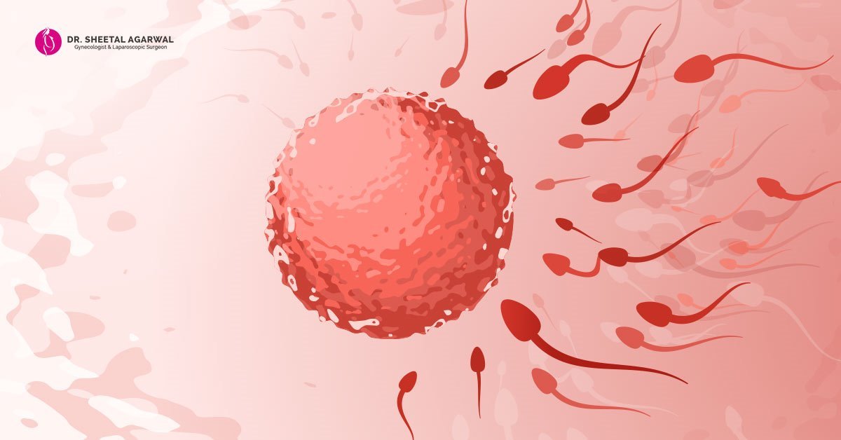 Vitro-Fertilisation-by-Dr-Sheetal-Agarwal
