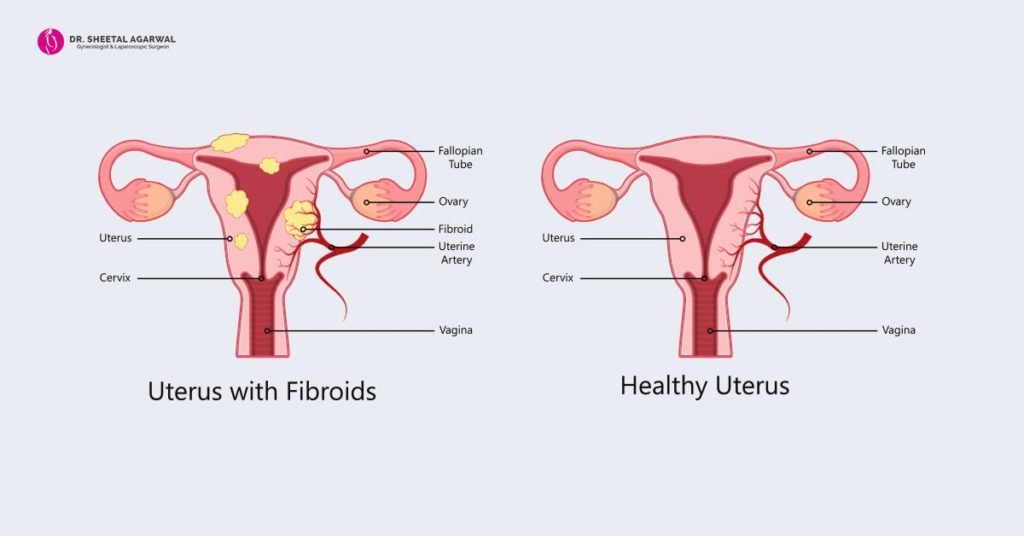 dr-sheetal-agarwal-laparoscopy-surgeon