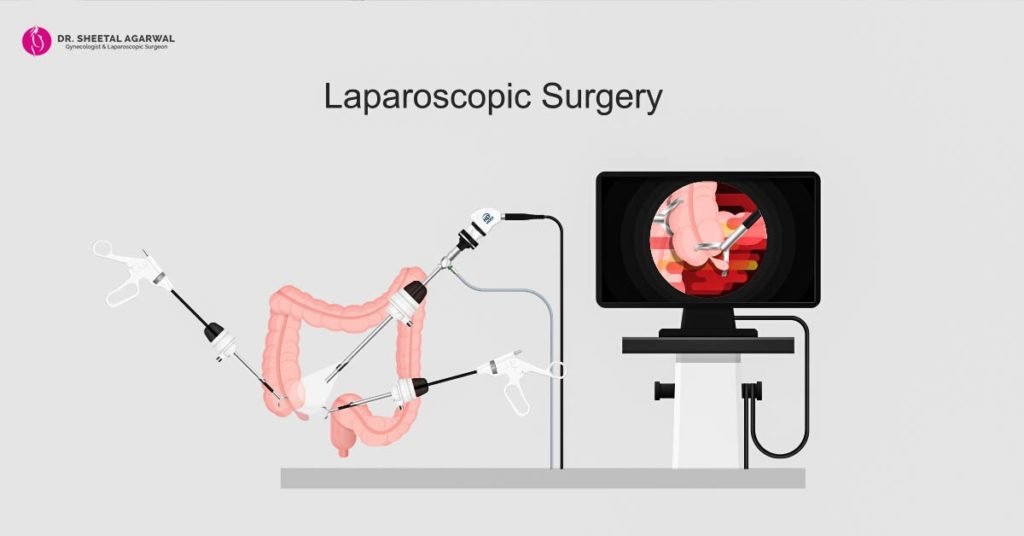 laparoscopy-surgeon-surgeon