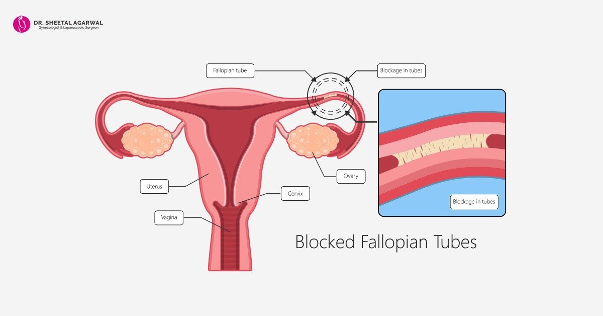 Laparoscopic-Surgeon