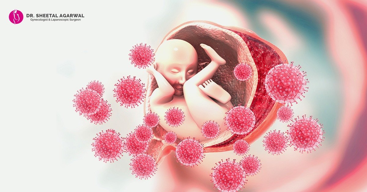 women-Prenatal-Infections